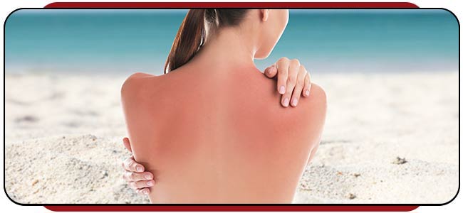 Sunburn Treatment Specialist Near Me in Rocky Mount, NC Sunburn Treatment Specialist Near Me in Rocky Mount, NC