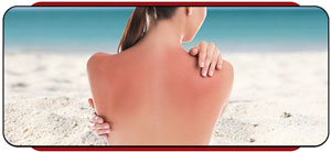 Sunburn Treatment Specialist Near Me in Rocky Mount, NC