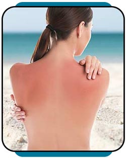 Sunburn Treatment Specialist Near Me in Rocky Mount, NC