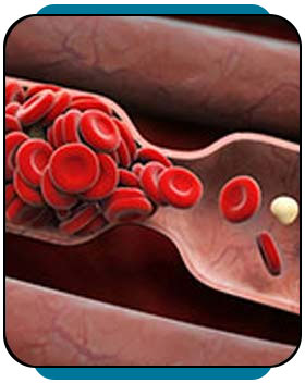 Coagulation Disorders Treatment Near Me in Rocky Mount, NC