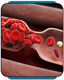 Coagulation Disorders Treatment Near Me in Rocky Mount, NC